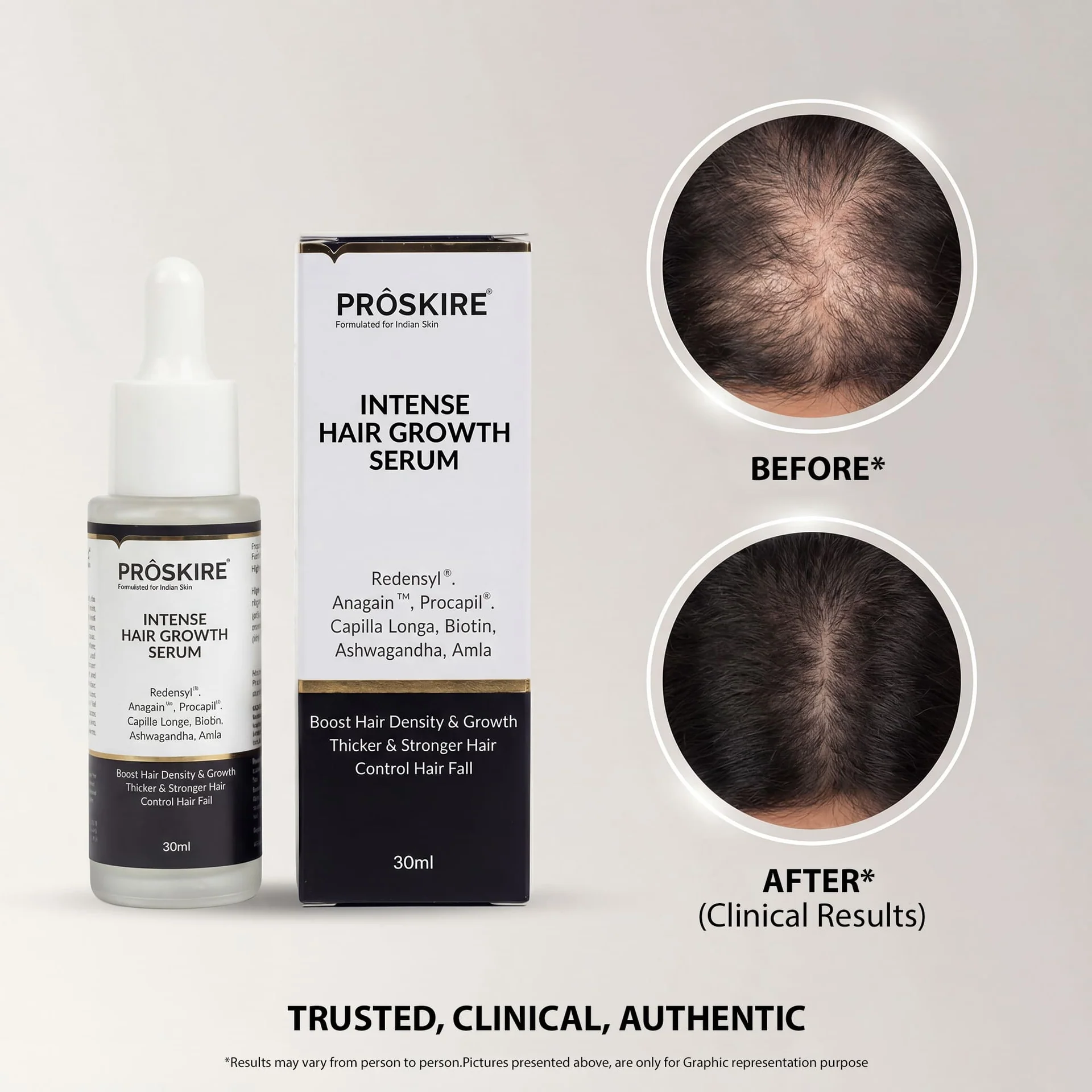 Proskire serum detail
